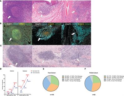 Follicle-like tertiary lymphoid structures: A potential biomarker for prognosis and immunotherapy response in patients with laryngeal squamous cell carcinoma